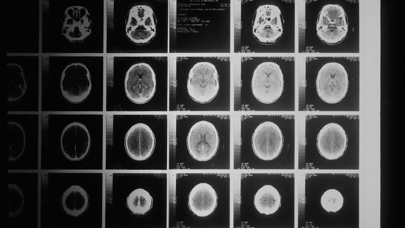 a black and white photo of various mri images